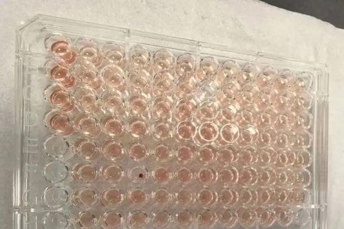 Một người Trung Quốc có 'máu Kim Cương' siêu quý hiếm