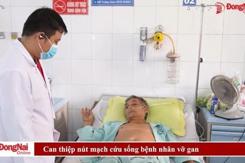Can thiệp nút mạch cứu sống bệnh nhân vỡ gan
