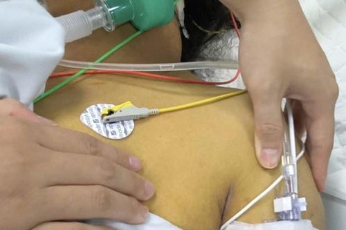 Người phụ nữ sốt cao 40 độ C, suy đa tạng vì loại vi khuẩn nguy hiểm thường gặp mùa bão lũ