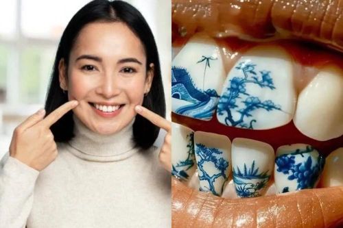 Giới trẻ Trung Quốc rộ trào lưu xăm hình lên... răng