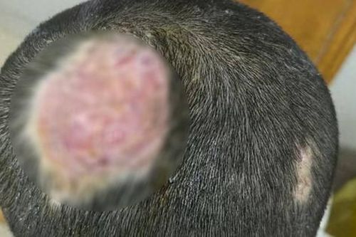 Cậu bé 6 tuổi hói vĩnh viễn vì nuôi thú cưng
