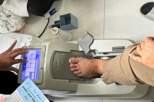 Khoảng 40% người trên 70 tuổi có nguy cơ loãng xương