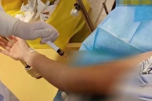 Người phụ nữ bị lở loét sau khi tiêm 100 mũi giảm cân, 57 vết thương trên hai cánh tay
