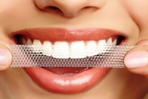 Rủi ro khi lạm dụng miếng dán trắng răng