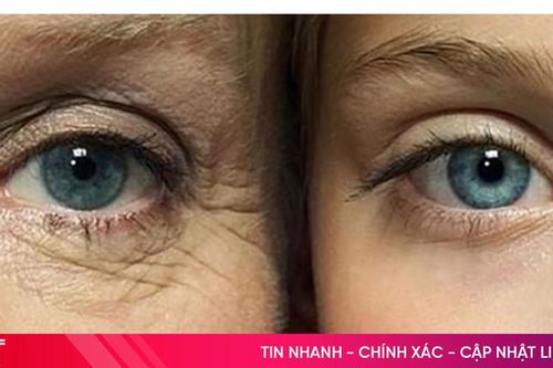 Trẻ hóa da vùng mắt hiệu quả với công nghệ HIFU hiện đại