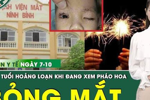 Bản Tin Y Tế 7/10: Đang xem pháo hoa, bé 2 tuổi bị bỏng mắt