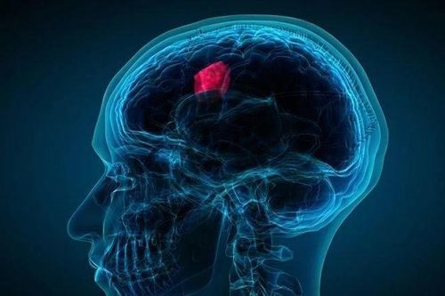 Rối loạn nội tiết hiếm gặp, người đàn ông uống 10 lít nước/ngày