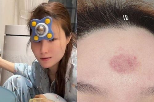 Diễm My 9X chăm con trai đến bầm tím cả trán, quý tử chưa tròn 1 tuổi đã phải học cả 'núi sách'