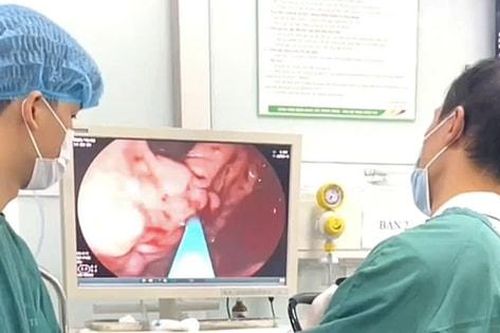 Xuất huyết tiêu hóa do vỡ giãn tĩnh mạch chảy thành tia