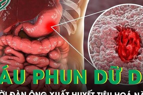 Vỡ tĩnh mạch dạ dày, máu phun dữ dội, người đàn ông thoát chết trong gang tấc nhờ kỹ thuật đặc biệt