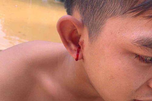 Đau điếng người vì rết chui vào tai khi chạy lũ ở Thái Nguyên