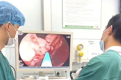 Cứu sống ca xuất huyết dạ dày nguy kịch