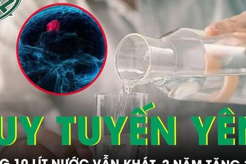 Mỗi ngày uống 10 lít nước vẫn khát, 2 năm tăng 30kg bất ngờ phát hiện suy tuyến yên