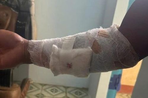 Truy tìm con cá sấu cắn nam thanh niên ở Khánh Hòa