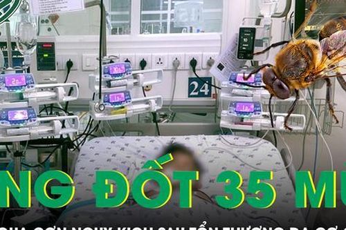 Bé trai 4 tuổi bị ong vò vẽ đốt 35 mũi qua cơn nguy kịch sau 3 tuần điều trị
