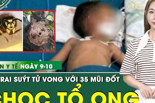 Bản Tin Y Tế 9/10: Bé trai suýt tử vong do chọc tổ ong vò vẽ