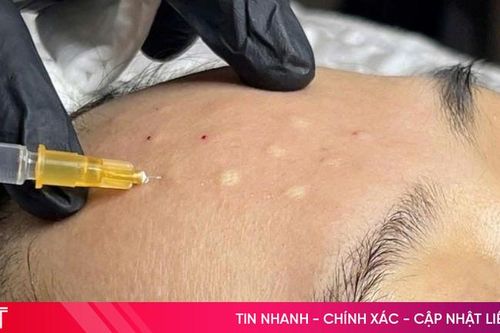 Hoạt động thẩm mỹ có xâm lấn trái phép vẫn tiếp tục diễn ra ở Hà Tĩnh