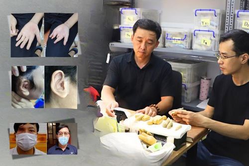 Đôi bạn Hà thành 'biến silicon thành da thịt' cho người khiếm khuyết