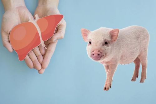 171 ngày kỳ diệu của người đàn ông sau ca ghép gan lợn