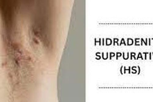 Thuốc trị viêm tuyến mồ hôi mủ