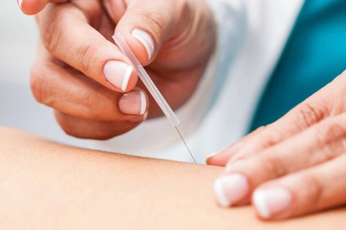 Cảnh giác biến chứng nặng sau tiêm kháng viêm điều trị hội chứng ống cổ tay