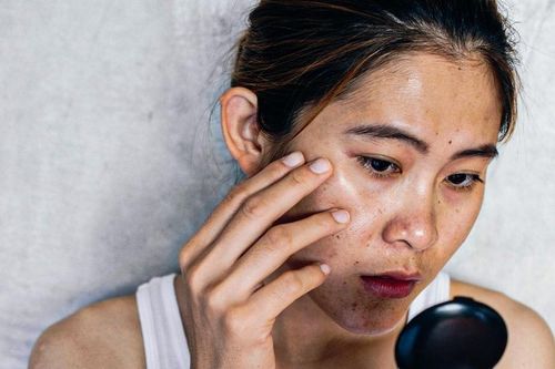 Tại sao khi bị bệnh lâu ngày da lại sạm đen?