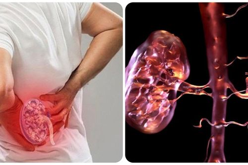 19 dấu hiệu thận yếu bạn không nên bỏ qua