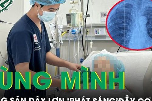 Rùng mình nang sán dây lợn 'phát sáng' vôi hóa đầy cơ thể