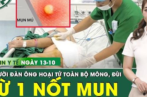 Bản Tin Y Tế 13/10: Chỉ từ 1 nốt mụn, người đàn ông hoại tử toàn bộ vùng mông đùi trái