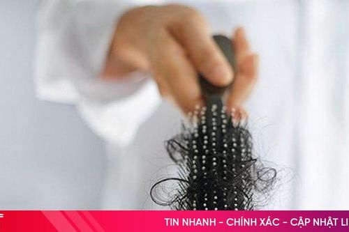 Vì sao tóc rụng nhiều?