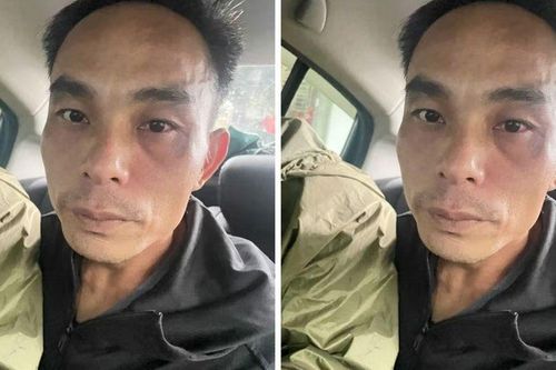 Bắt Bùi Văn Huynh, đối tượng cướp xe máy của hai chị em gái trong đêm, đẩy bé gái 5 tuổi ngã xuống đường rồi bỏ chạy