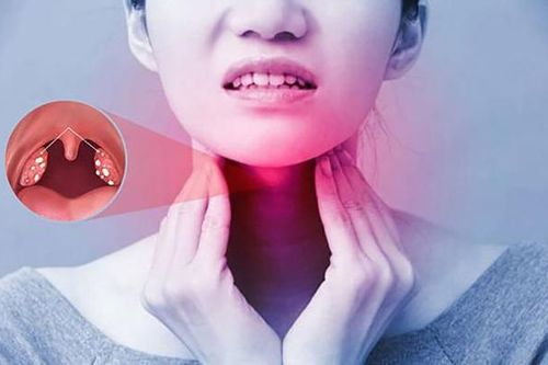 Phân biệt viêm họng và ung thư vòm họng