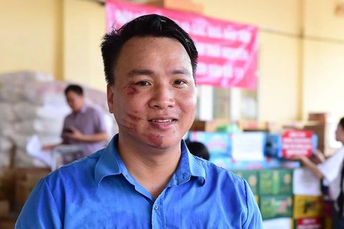Vết thương trên mặt của Bí thư đoàn phường ở 'rốn lũ' Thái Nguyên