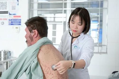 Người đàn ông 43 tuổi bị dị ứng nặng, nhập viện gấp do mắc sai lầm này khi dùng thuốc