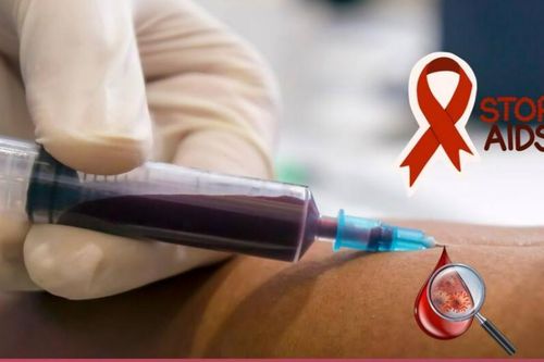 Tầm quan trọng của các loại xét nghiệm HIV trong kiểm soát và quản lý bệnh