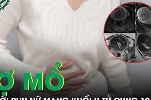 Người phụ nữ mang khối u xơ tử cung gần 5kg suốt 10 năm vì tin rằng 'u sẽ tự hết'
