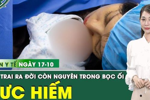 Bản tin Y tế 17/10: Đỡ đẻ thành công cặp song sinh hiếm gặp còn nguyên trong bọc ối