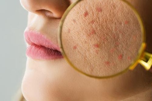 6 dấu hiệu trên da cảnh báo gan cần được chăm sóc ngay