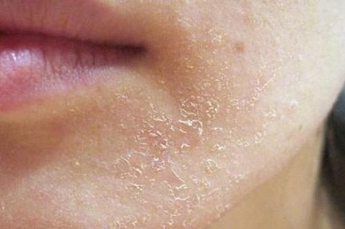 Làn da vào thu: Khi dưỡng ẩm trở thành 'chìa khóa' vàng