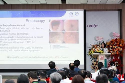 Việt Nam đón đầu các kỹ thuật mới trong điều trị nhu động thần kinh ruột