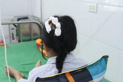 Tình trạng sức khỏe của bé gái lớp 5 bị bố dượng dùng búa đánh vào đầu