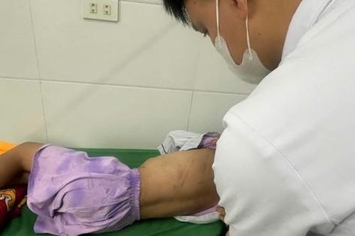 Vụ bé gái lớp 5 bị cha dượng bạo hành: 'Bố uống rượu vào thường hay đánh con'