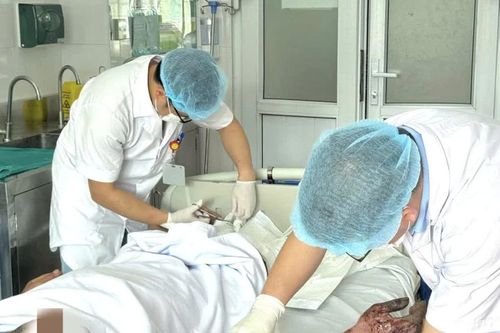 Người đàn ông không chạm vào điện vẫn bị bỏng nặng do tia hồ quang