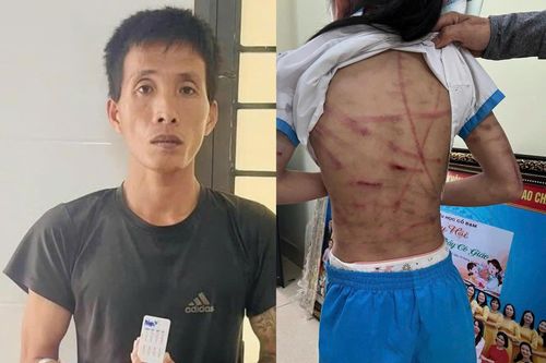 Bài học đắt giá nhìn từ vụ cha dượng bạo hành dã man bé gái ở Hà Tĩnh