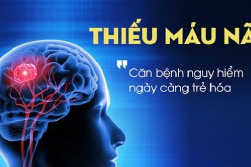 Bí quyết giảm nguy cơ cơn thiếu máu não thoáng qua