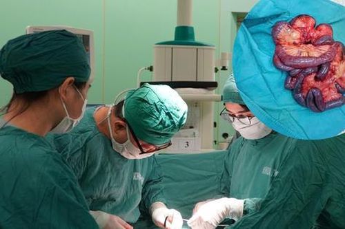 Nam bệnh nhân hoại tử gần 5m ruột non do tắc động mạch hiếm gặp