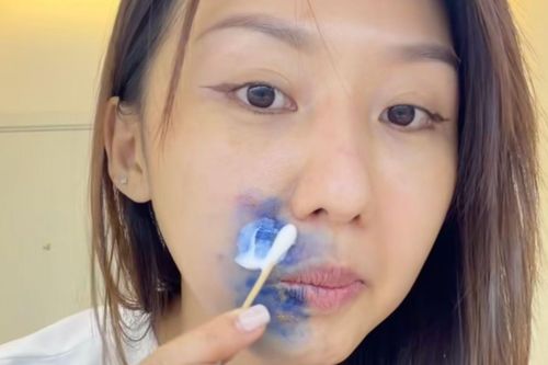 Cô gái TP.HCM mắc zona thần kinh sau khi dùng chung đồ make up