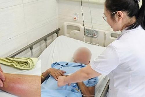 Suýt mất khả năng đi lại vì cấy chỉ chữa thoát vị đĩa đệm