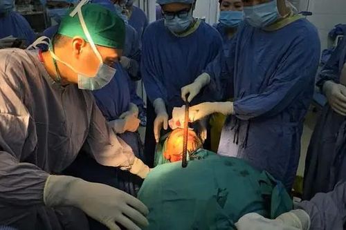 Giành lại sự sống cho bệnh nhân bị thanh sắt xuyên mặt