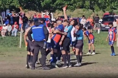 Cầu thủ 'nổi điên' húc đầu khiến trọng tài gãy 2 răng